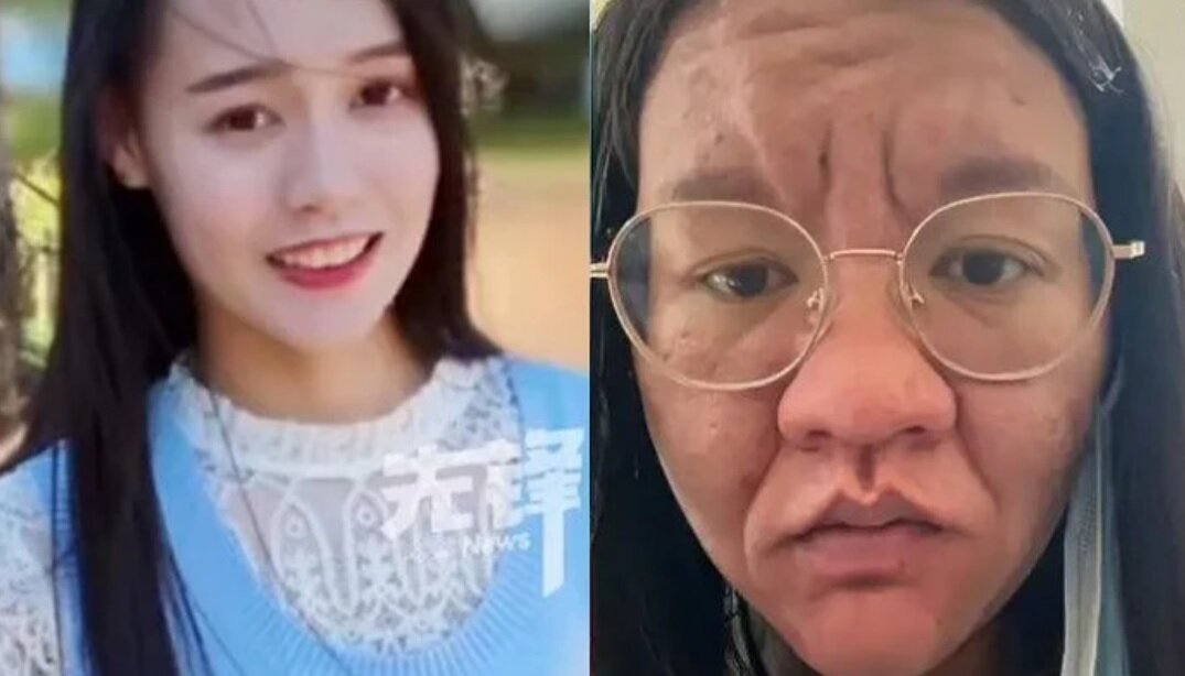 تغییر عجیب چهره یک زن چینی در دوران بارداری/ عکس