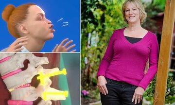 عطسه شدید این زن را دو سال فلج کرد/ عکس