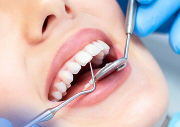کلینیک دندانپزشکی یا مطب شخصی؟ راز انتخاب درست برای درمان بهتر