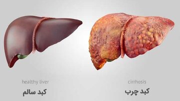 خوراکیهای مفید و مضر برای کبد را بشناسید خوراکیهای مفید و مضر برای کبد را بشناسید