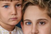 وقتی رنگ‌ چشم‌ها متفاوت است/ عکس