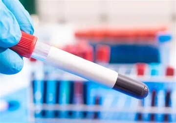 شناسایی سرطان تا ۳ سال پیش از بروز علائم با آزمایش خون جدید! شناسایی سرطان تا ۳ سال پیش از بروز علائم با آزمایش خون جدید!