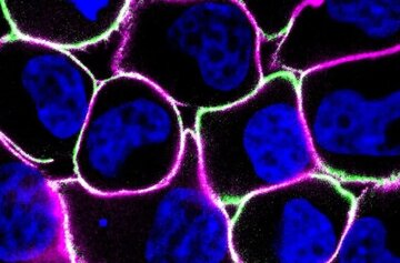 تشخیص سرطان با نور ممکن شد تشخیص سرطان با نور ممکن شد