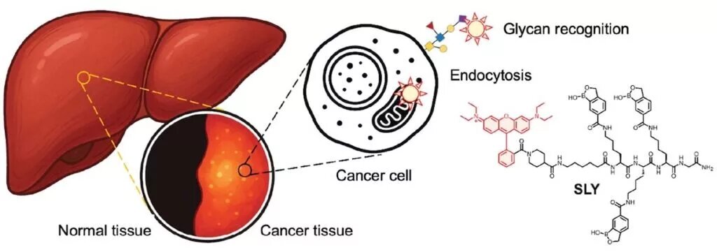 تشخیص سرطان با نور ممکن شد