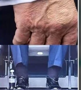 بیماری ترامپ چیست؟ چرا رییسجمهور آمریکا بند کفشهایش را نصفه بسته بود؟/ عکس