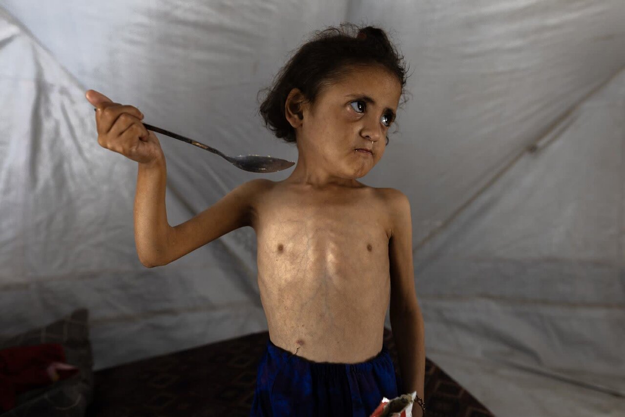 تصاویری هولناک از قحطی،گرسنگی و مرگ در غزه