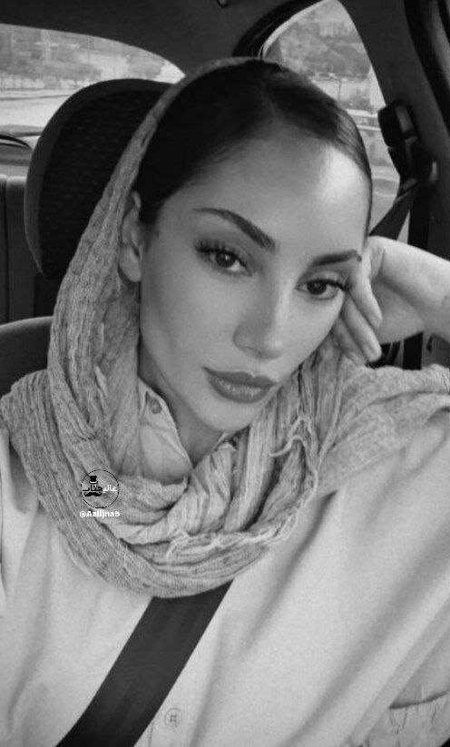 عکس | تغییر چهره مجدد ترلان پروانه؛ این بازیگر زن چه کرده است؟