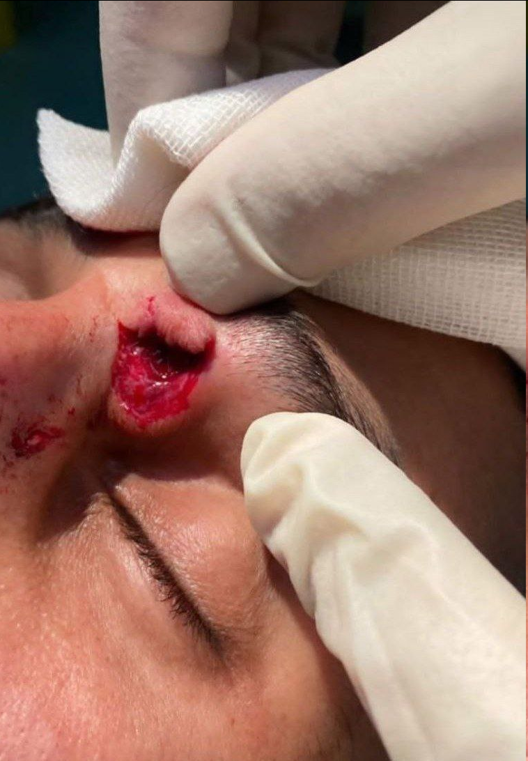 عکس| مصدومیت شدید علی علیپور در تمرین پرسپولیس