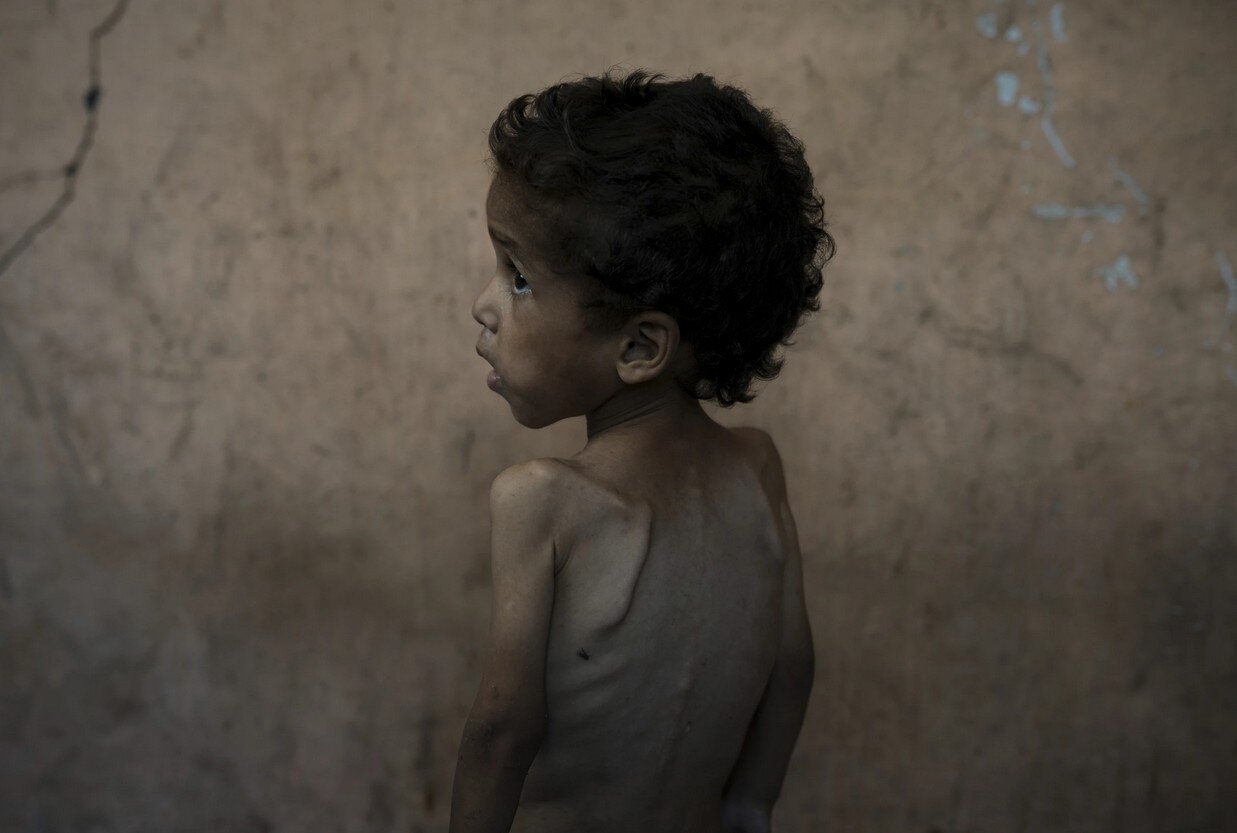 آسوشیتدپرس:آنها در آغوش مادرشان به آرامی درحال تحلیل رفتن هستند/تصاویر