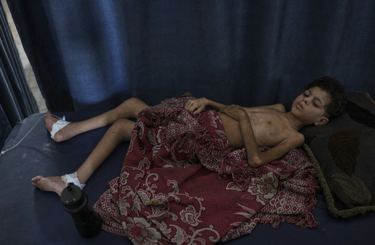 آسوشیتدپرس:آنها در آغوش مادرشان به آرامی درحال تحلیل رفتن هستند/تصاویر