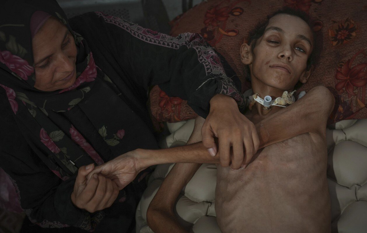 آسوشیتدپرس:آنها در آغوش مادرشان به آرامی درحال تحلیل رفتن هستند/تصاویر