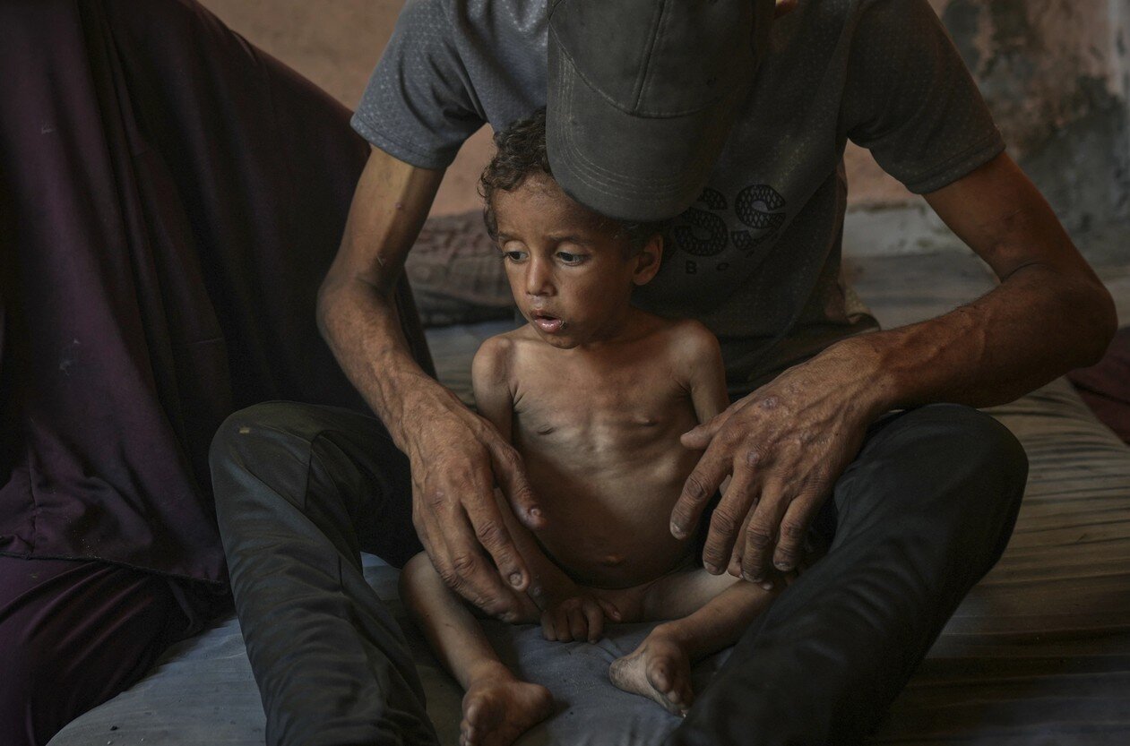 آسوشیتدپرس:آنها در آغوش مادرشان به آرامی درحال تحلیل رفتن هستند/تصاویر