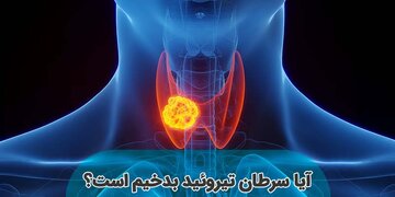 آیا سرطان تیروئید بدخیم کشنده است؟