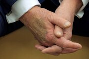 ببینید | کبودی دست ترامپ دوباره خبرساز شد؛ گمانه‌زنی‌ها درباره سلامت رئیس‌جمهور سابق آمریکا