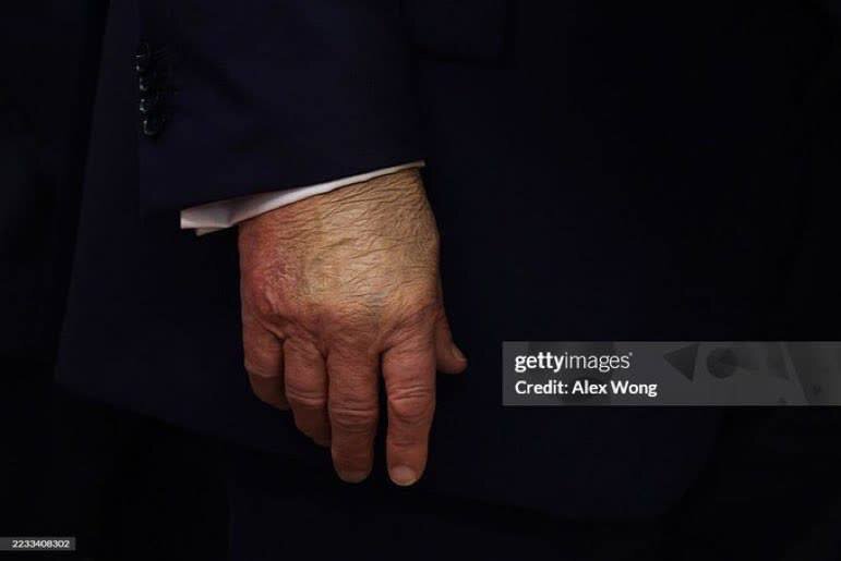 عکس | تصویر وایرال شده از دست راست ترامپ