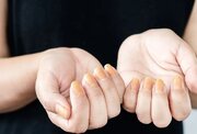 رنگ زرد ناخن نشانه چیست؟