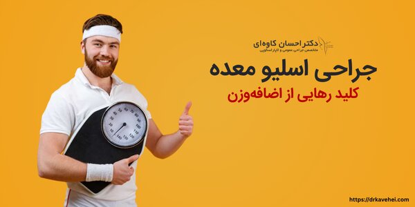 عمل اسلیو معده
