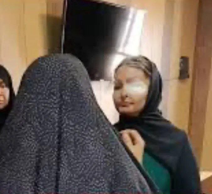 قربانی اسیدپاشی ضارب خود را پس از ۱۱ سال بخشید/ چرا سیما افشاری مورد اسیدپاشی قرار گرفت؟