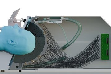 کشف روش جدید برای درمان پارکینسون کشف روش جدید برای درمان پارکینسون