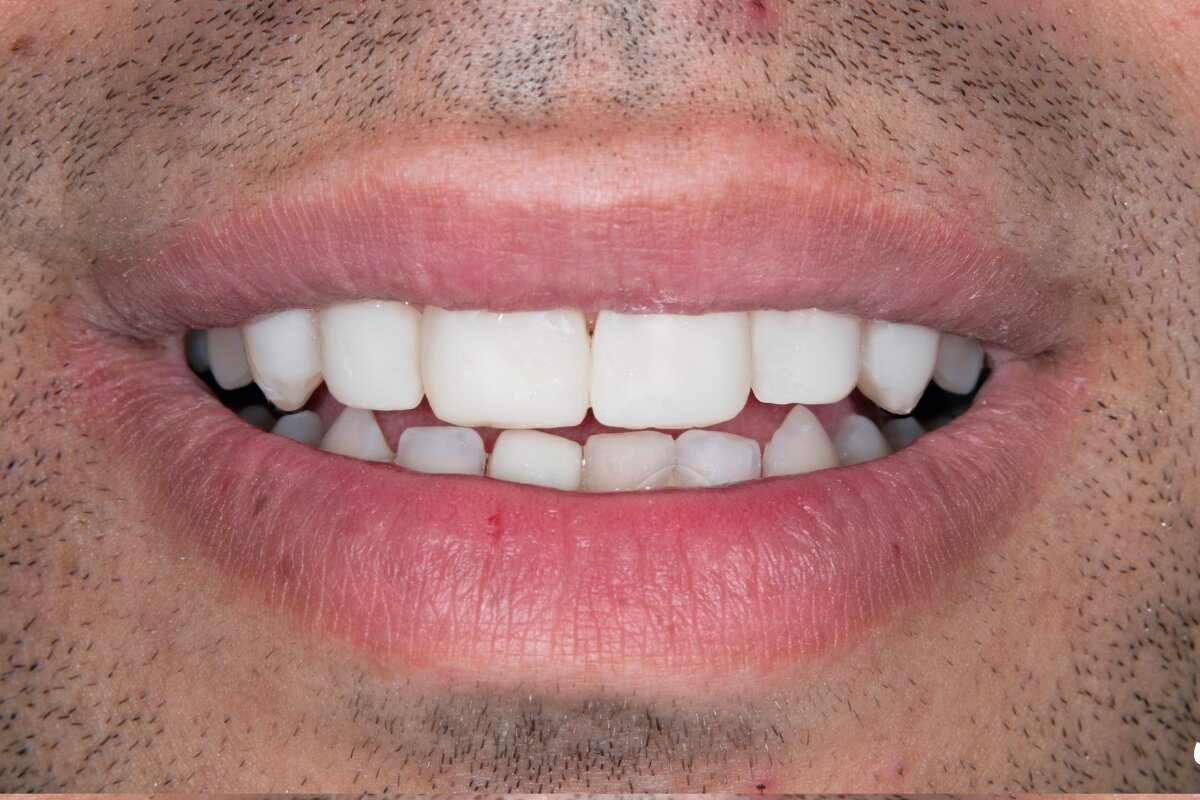 نمونه کار دندانپزشکی در غرب تهران