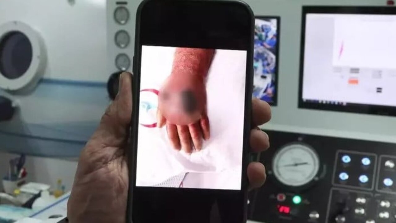 مغازهدار استانبولی، قربانی دندانهای سارق حرفهای شد/ عکس