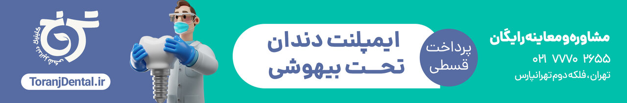 ایمپلنت دندان تحت بیهوشی