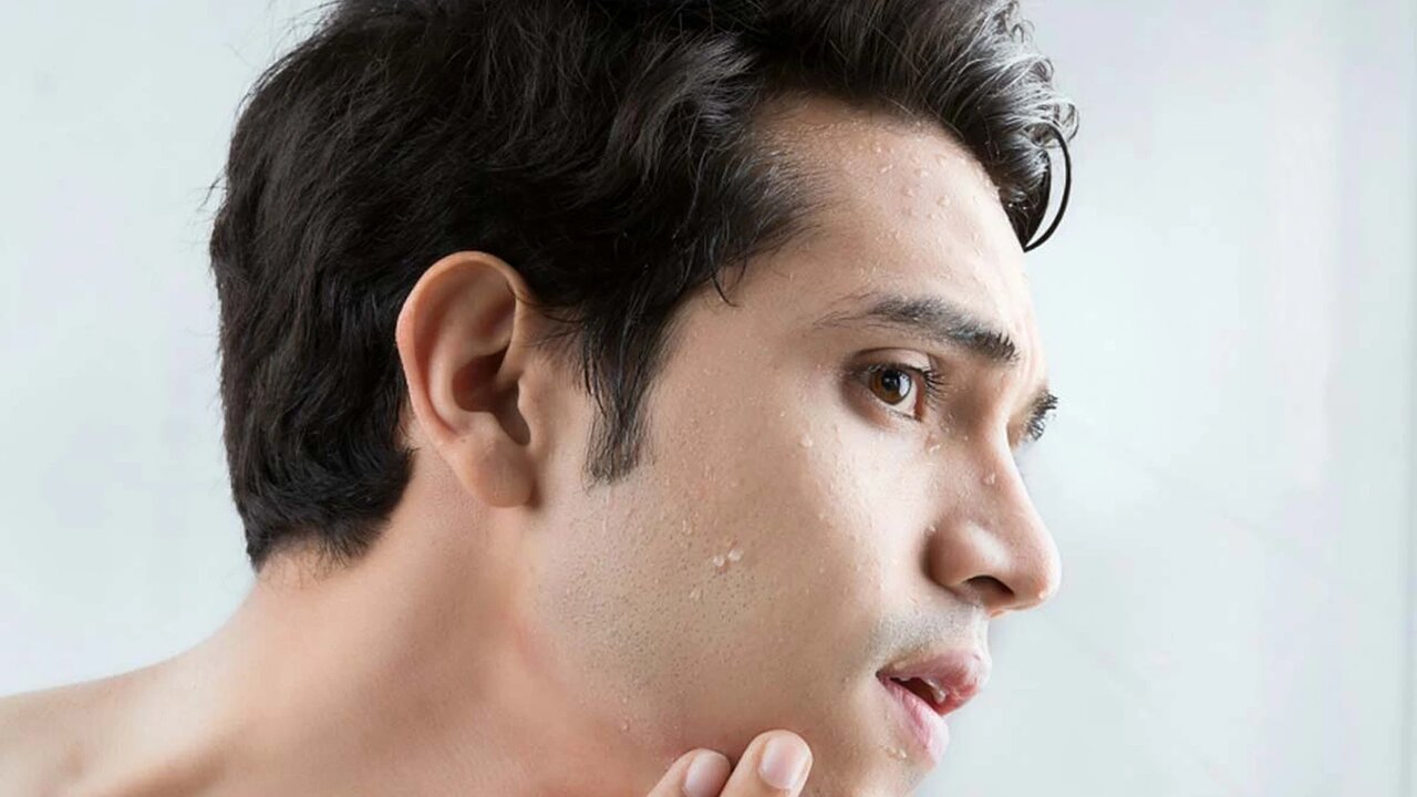 پیری زودرس پوست