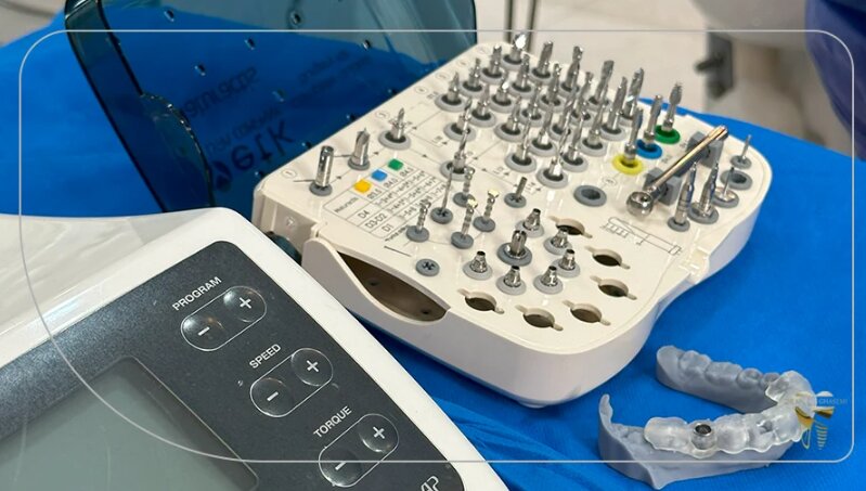 فناوریهای کلیدی در ایمپلنت دیجیتال: نوآوریهای 2026