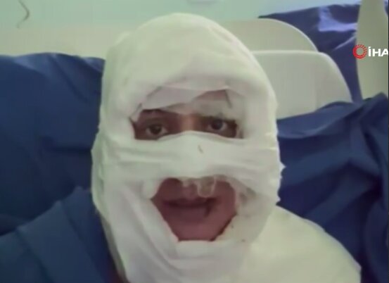 ببینید | لحظه هولناک اسیدپاشی به صورت یک زن جوان وسط کافه!