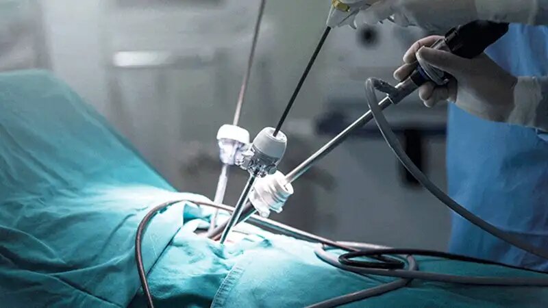 استانداردهای جهانی در جراحی چاقی ایران