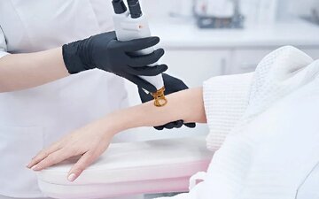 ۹ مورد از عوارض وحشتناک لیزر موهای زائد