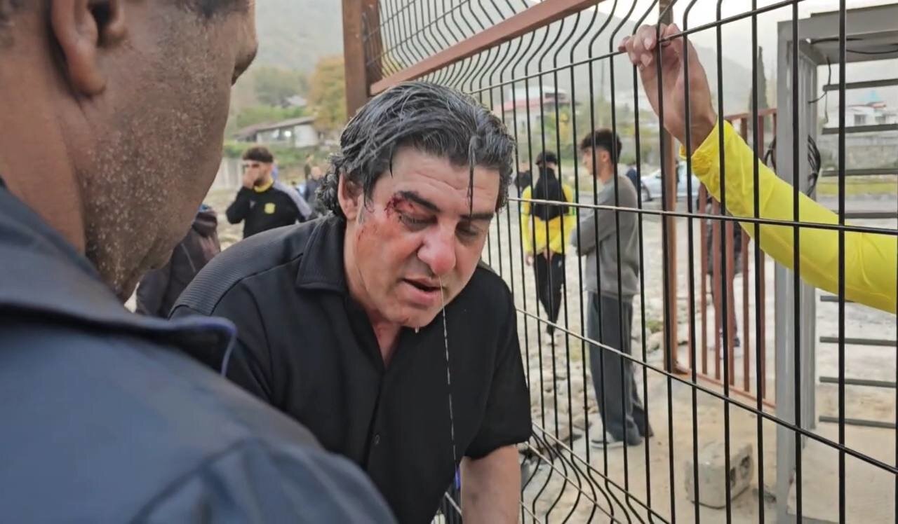 عکس | جزئیات تکان دهنده از درگیری و خونریزی در بازی لیگ یک