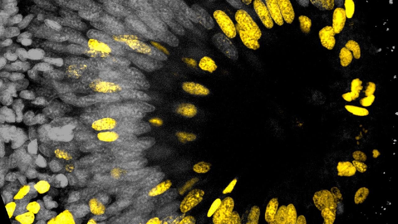 چشمی که هرگز پیر نمی‌شود