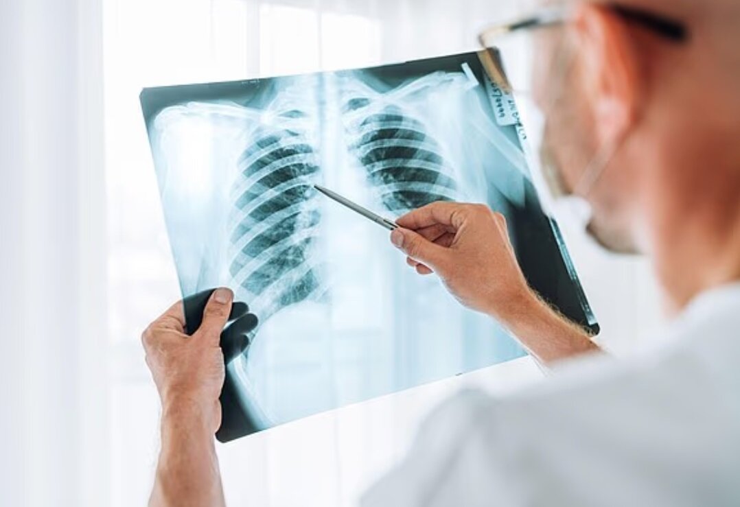 دلایل مرگبار بودن آنفلوآنزا چیست؟ دلایل مرگبار بودن آنفلوآنزا چیست؟