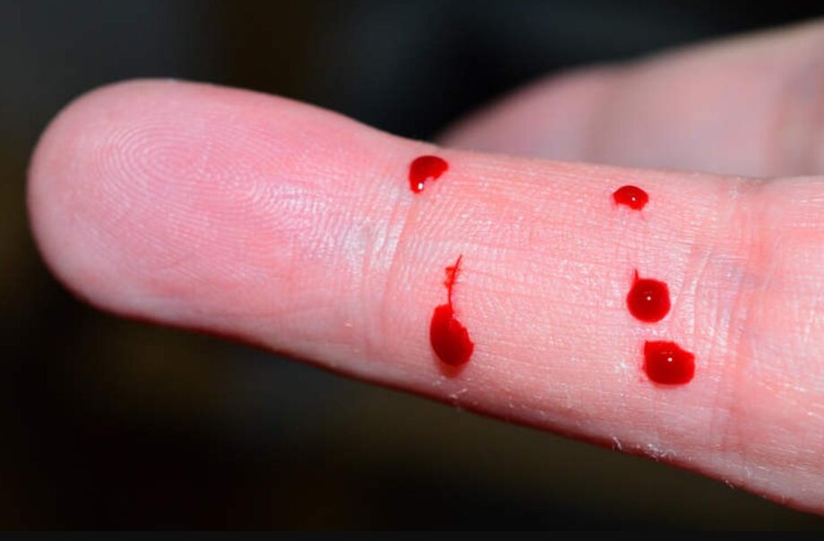 نوجوانی که با خونش را خورد و مسموم شد 2