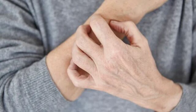 این علامتها نشاندهنده وجود بیماریهای پوستی هستند. این علامتها نشاندهنده وجود بیماریهای پوستی هستند.