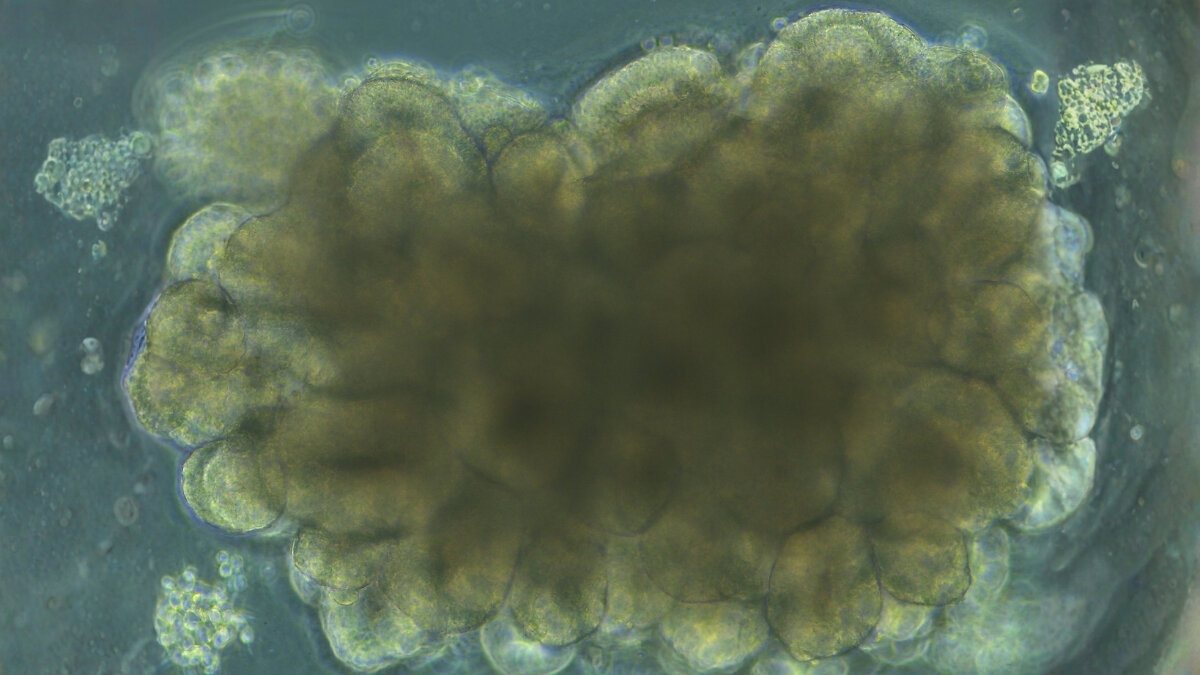 دانشمندان موفق به ایجاد «مینیمغز» شده و به این ساختار یادگیری حل مسائل را آموزش دادند. دانشمندان موفق به ایجاد «مینیمغز» شده و به این ساختار یادگیری حل مسائل را آموزش دادند.