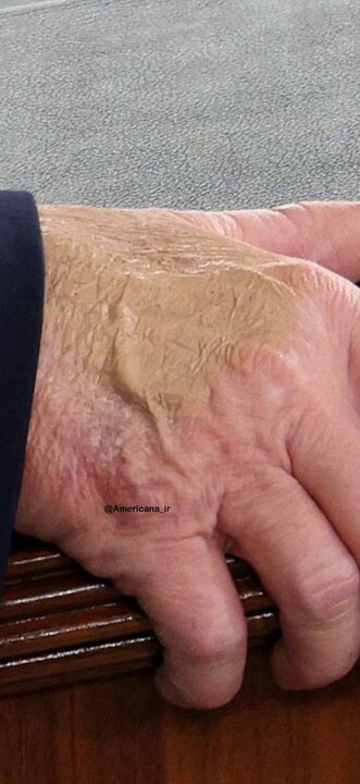 وضعیت دست ترامپ در جریان سخنرانی در کنگره آمریکا