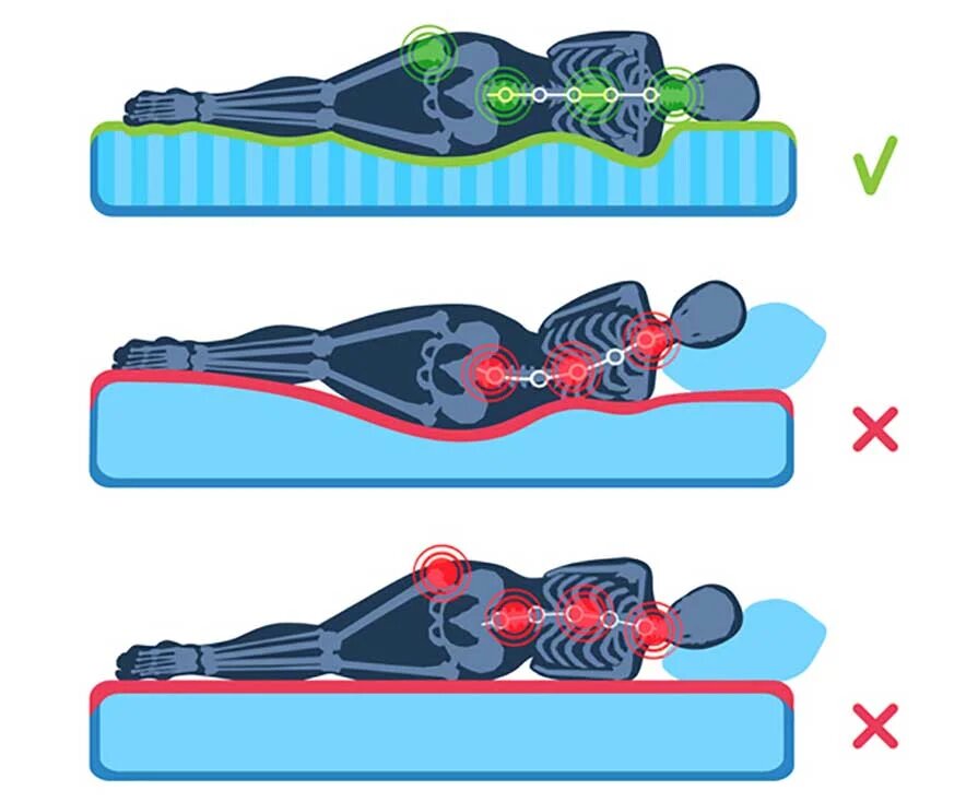 تشک طبی یا طبی فنری برای دیسک کمر