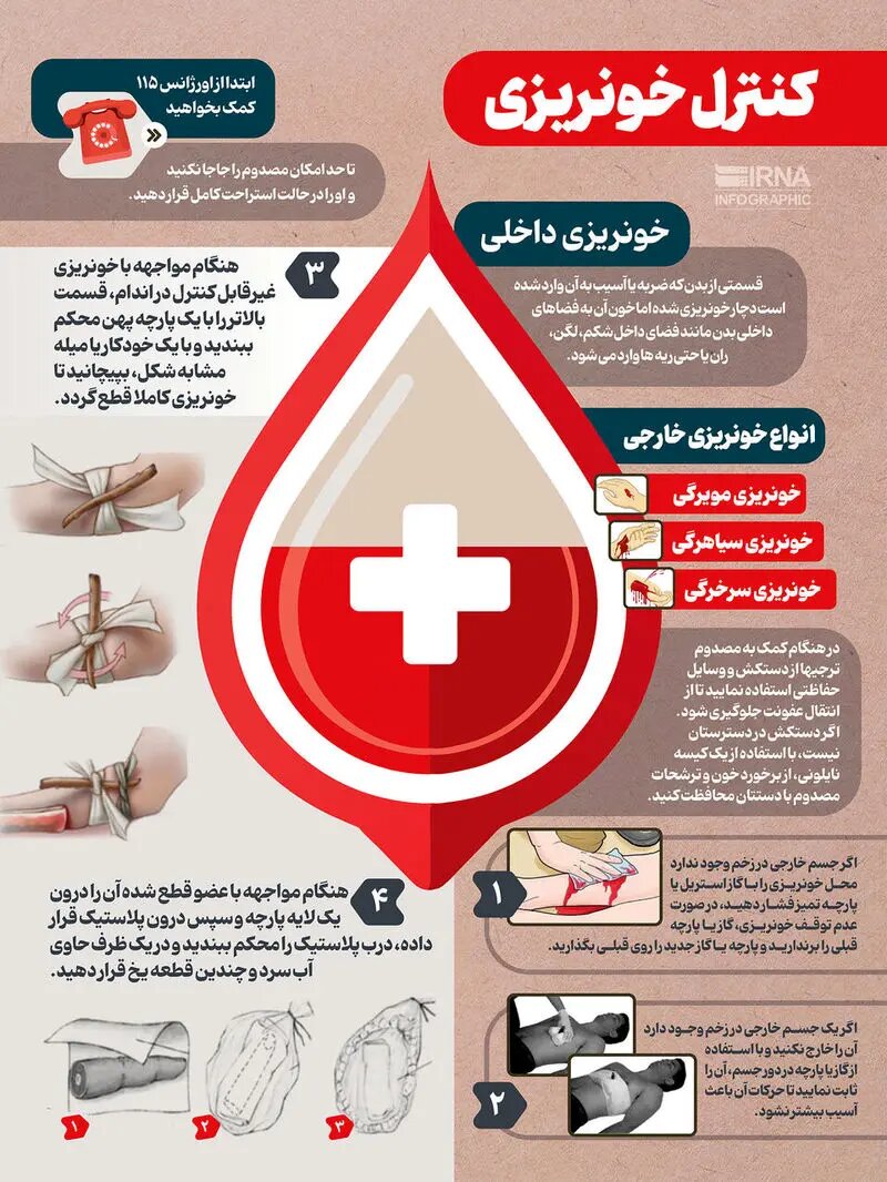 اینفوگرافیک/ اقدامات فوری برای کنترل خونریزی هنگام جنگ