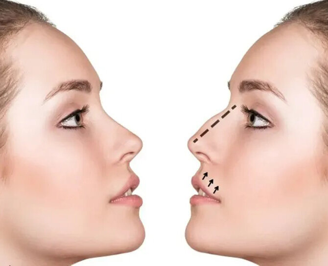 راهنمای انتخاب کلینیک جراحی بینی در ایلام