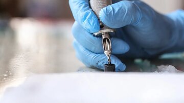 خالکوبی روی دست کودک ۲۲ماهه، پلیس: شرایط خانه اسفناک بود/ عکس
