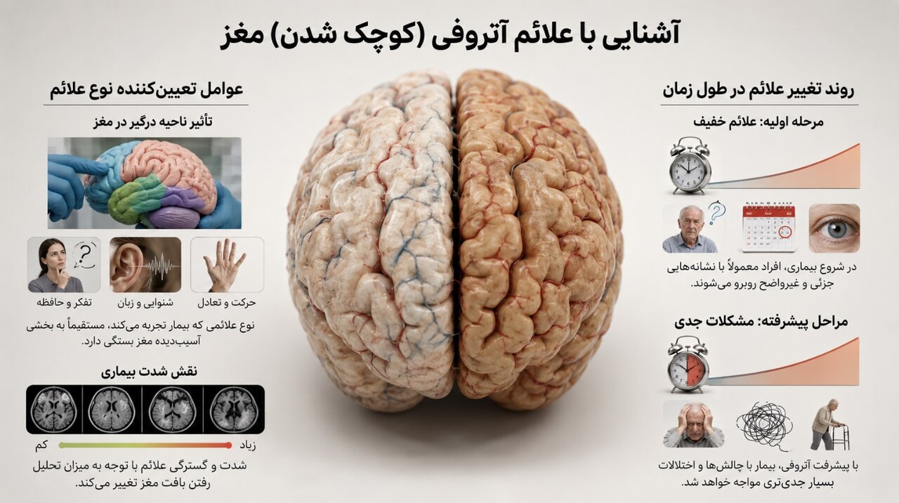 آتروفی مغزی یا کوچک شدن مغز در سالمندان چیست؟ علائم، علتها و روشهای کنترل بیماری
