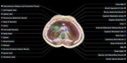 اسکن بدن بدون نیاز به دستگاه MRI / پروژه بلندپروازانه «میدجرنی مدیکال»