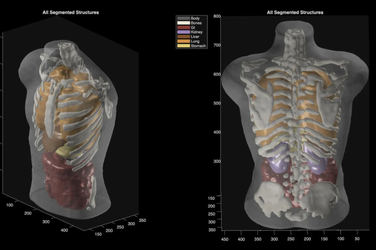 اسکن بدن بدون نیاز به دستگاه MRI / پروژه بلندپروازانه «میدجرنی مدیکال»