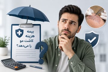 بیمه هزینه کاشت مو را می‌دهد یا نه؟ آنچه متقاضیان باید بدانند