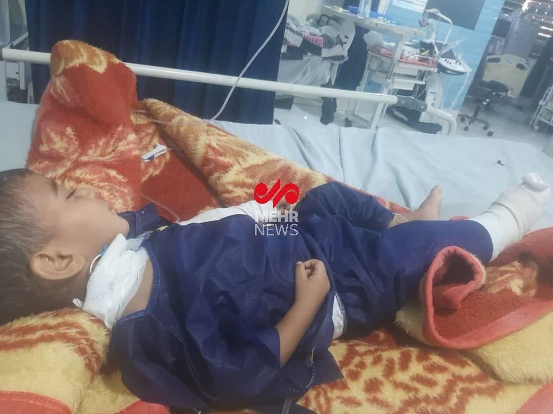 عکس کودکی که در اثر حملات آمریکا به تپه الله اکبر بندرعباس مجروح شد