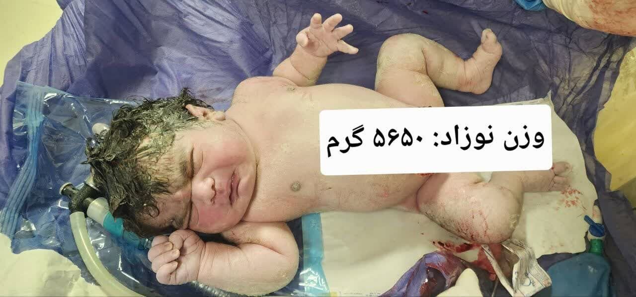 تولد نوزادی با وزن ۵ کیلو و ۶۵۰ گرم در کرمانشاه ثبت شد/ تصویر تولد نوزادی با وزن ۵ کیلو و ۶۵۰ گرم در کرمانشاه ثبت شد/ تصویر