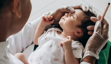 حجامت گوش نوزادان برای درمان زردی موثر است؟/ پاسخ یک متخصص حجامت گوش نوزادان برای درمان زردی موثر است؟/ پاسخ یک متخصص