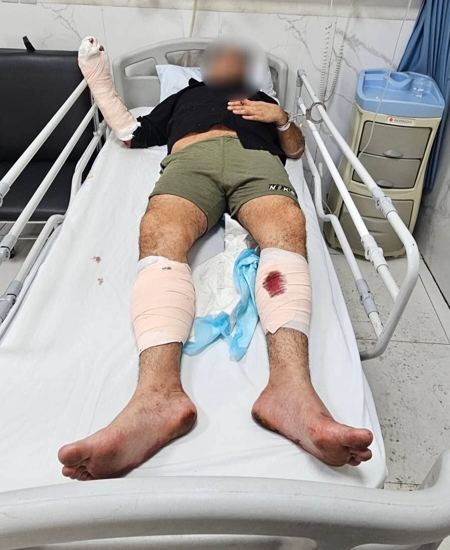 عامل ضربوشتم زنان در ویدئوهای اینستاگرام، با شلیک پلیس زمینگیر شد/ هویت «نوید» متولد ۱۳۶۹ شناسایی شد/ عکس